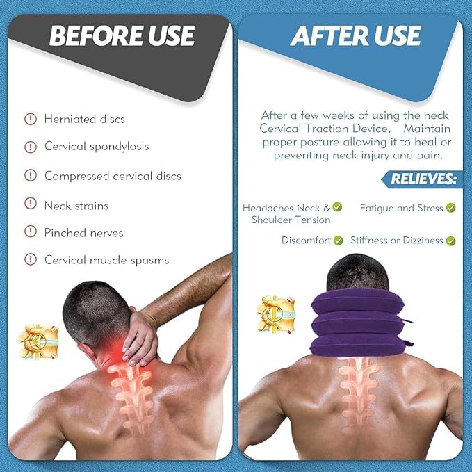 Jaximy Neck Stretcher, Neck Traction Device, Cervical Traction Device, Neck Pain Relief, Adjustable Inflatable Neck Brace & Neck Stretcher Cervical Traction, Neck Decompression Home Use (Purple)