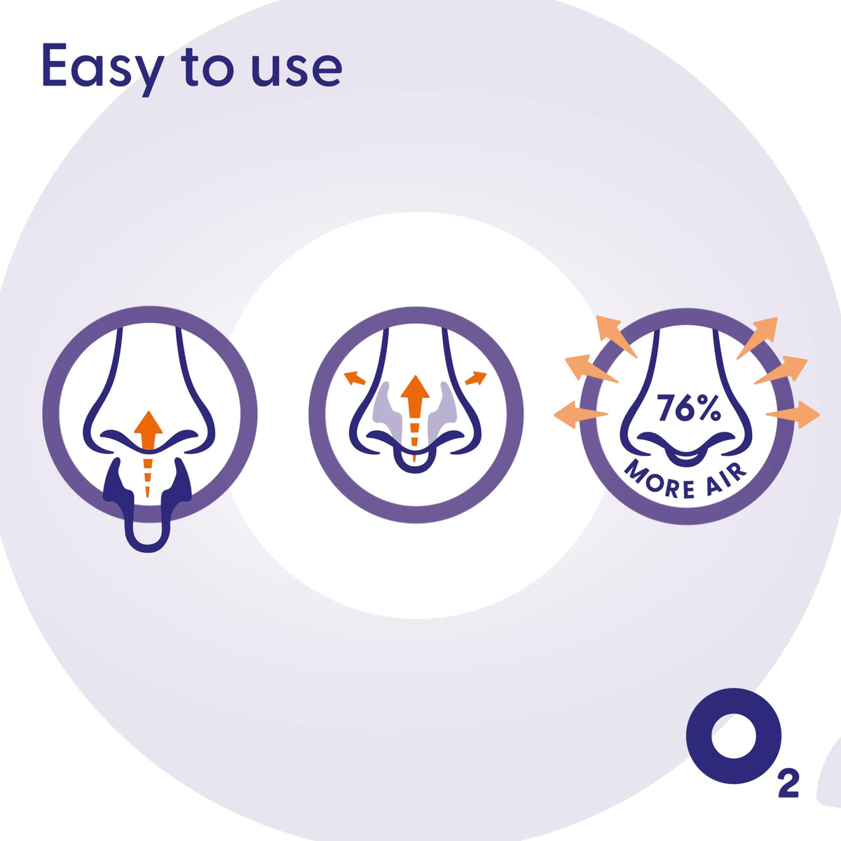 AIRMAX Nasal dilators for Sleeping - 76% More Airflow - Anti snoring Devices - Breathe Freely Through The Nose - Sinus Relief, Relief and snoring Solution - 2X Medium Orange - 6 Month Relief