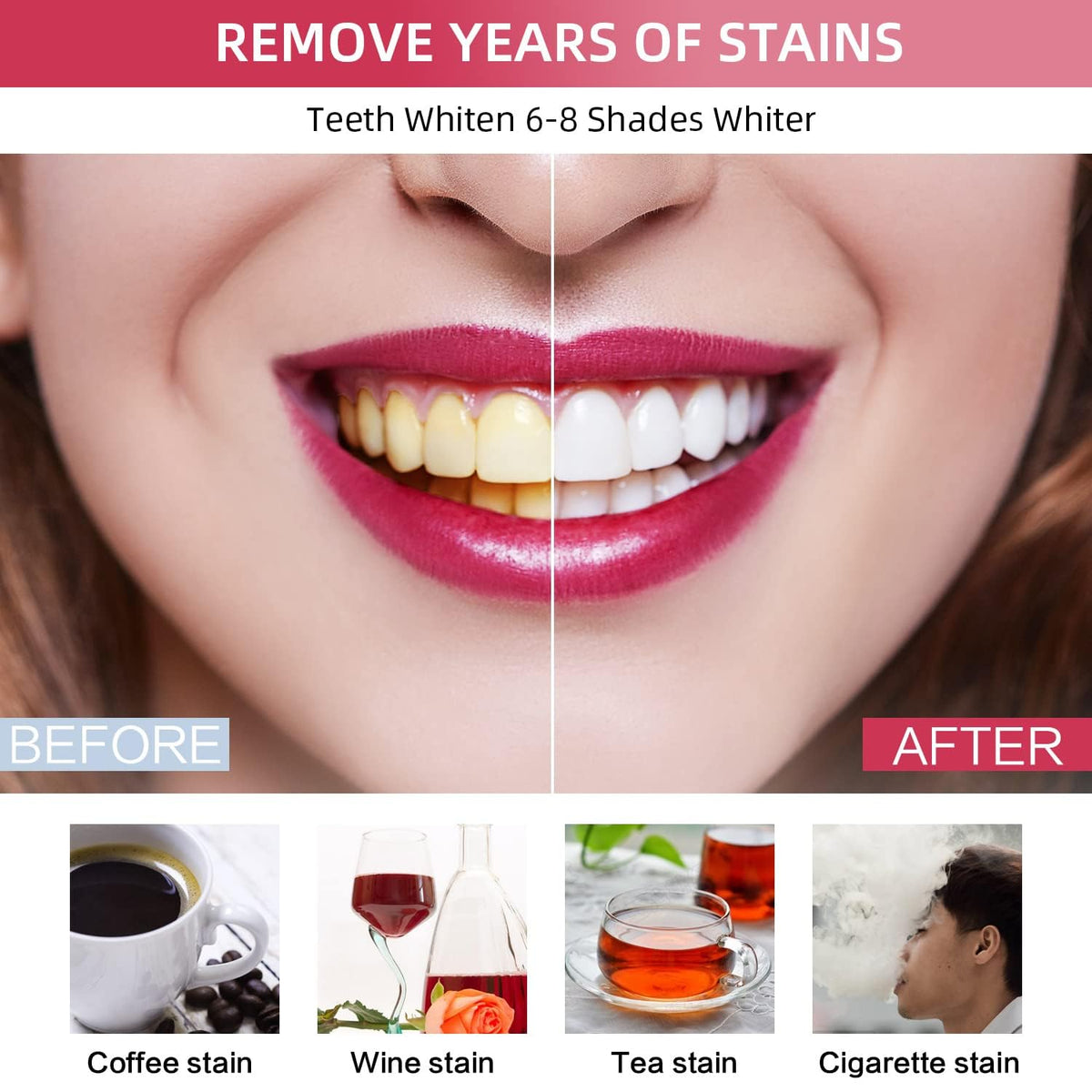 Pdoo Teeth Whitening Kit with LED Light for Sensitive Teeth, Fast Results for Brightening at Home, Teeth Whitening Gel Helps Remove All Kinds of Stains